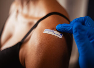 What’s mole mapping? The skin cancer screening using AI to monitor your health mole mapping